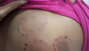 Homem é preso em flagrante suspeito de agredir companheira com socos e mordidas em Pinheiro