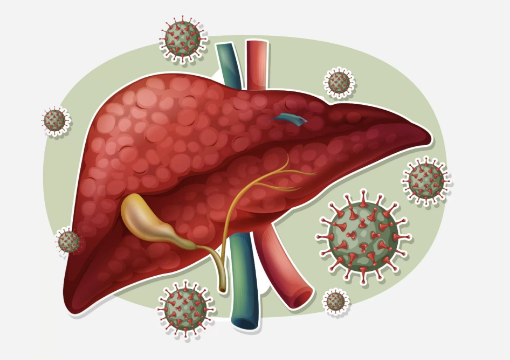 Hepatites virais no Maranhão: estado registra mais de 14 mil casos e 1.228 mortes; especialistas alertam para diagnóstico precoce